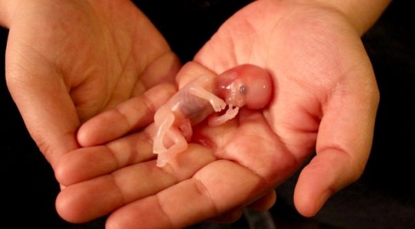 Article : L’avortement : consolation ou pénitence ?!